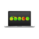 Электроэнцефалограф - Неврологическая система SOMNOscreen plus EEG 32 Tele 1 (BT) с видеокамерой Электроэнцефалограф - Неврологическая система SOMNOscreen plus EEG 32 Tele 1 (BT) с видеокамерой