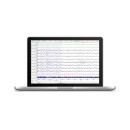 Электроэнцефалограф - Неврологическая система SOMNOscreen plus EEG 32 Tele 1 (BT) с видеокамерой Электроэнцефалограф - Неврологическая система SOMNOscreen plus EEG 32 Tele 1 (BT) с видеокамерой
